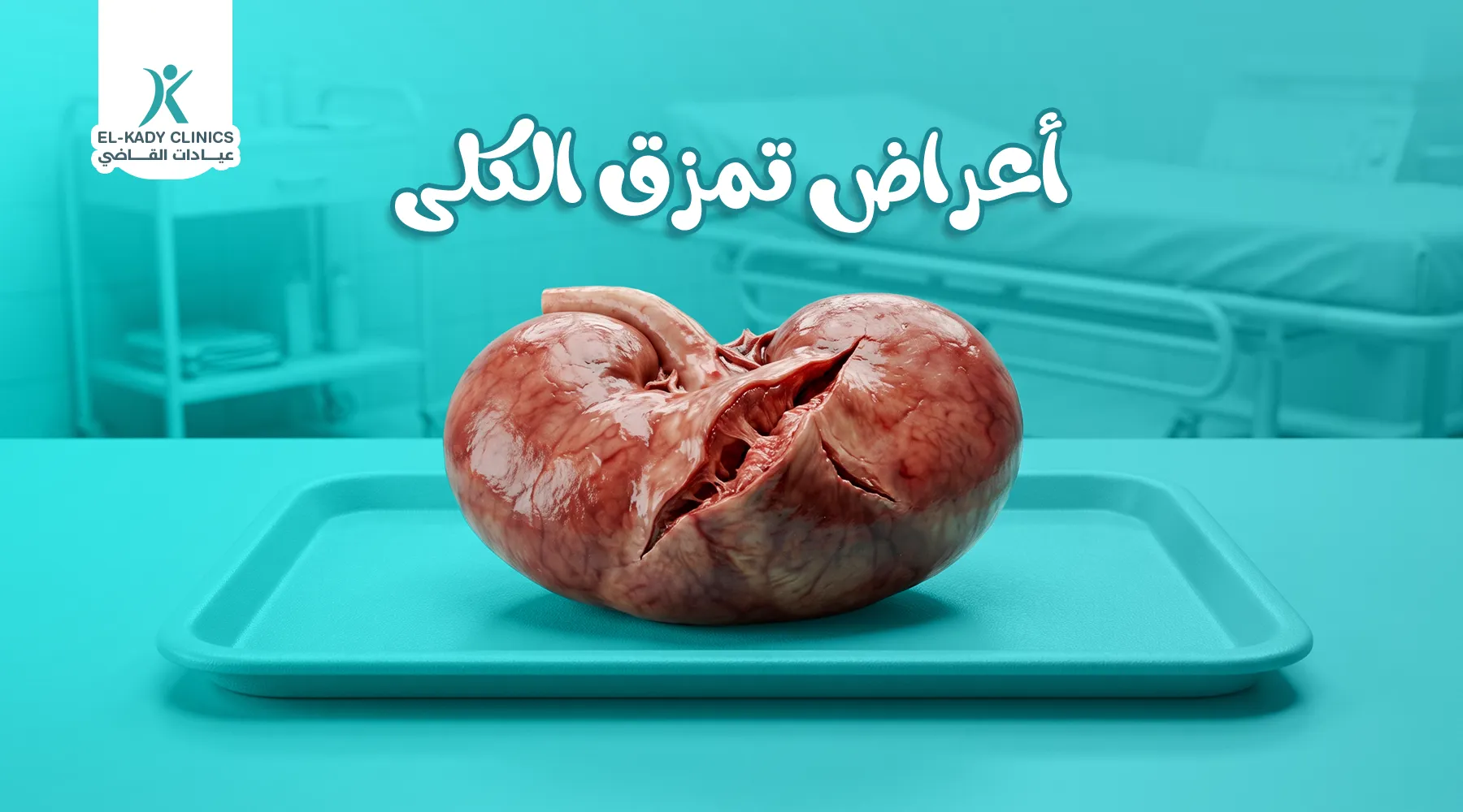 أعراض تمزق الكلى وعلاجه عند الأطفال
