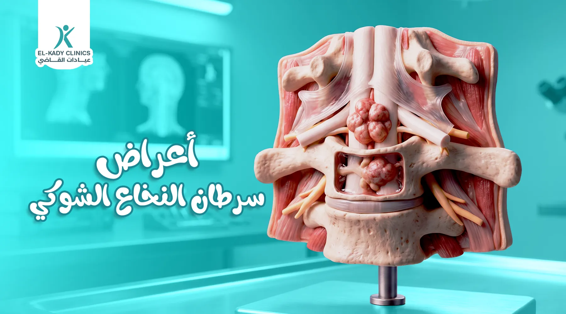 أعراض سرطان النخاع الشوكي عند الأطفال