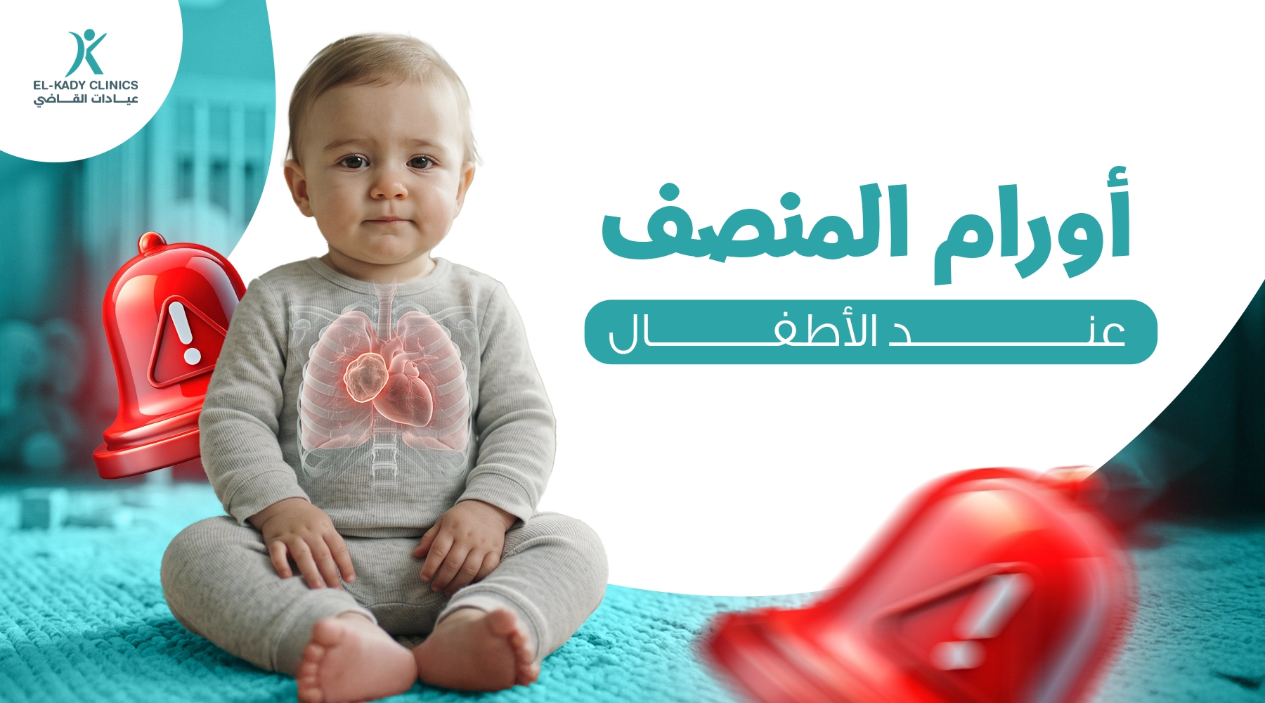 أورام المنصف عند الأطفال
