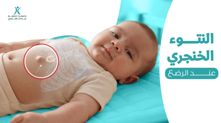 النتوء الخنجري عند الرضع