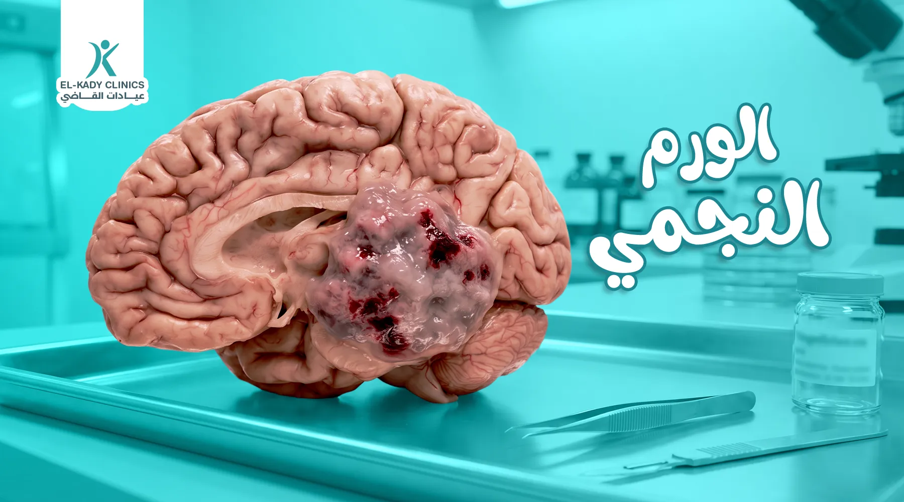 الورم النجمي عند الأطفال