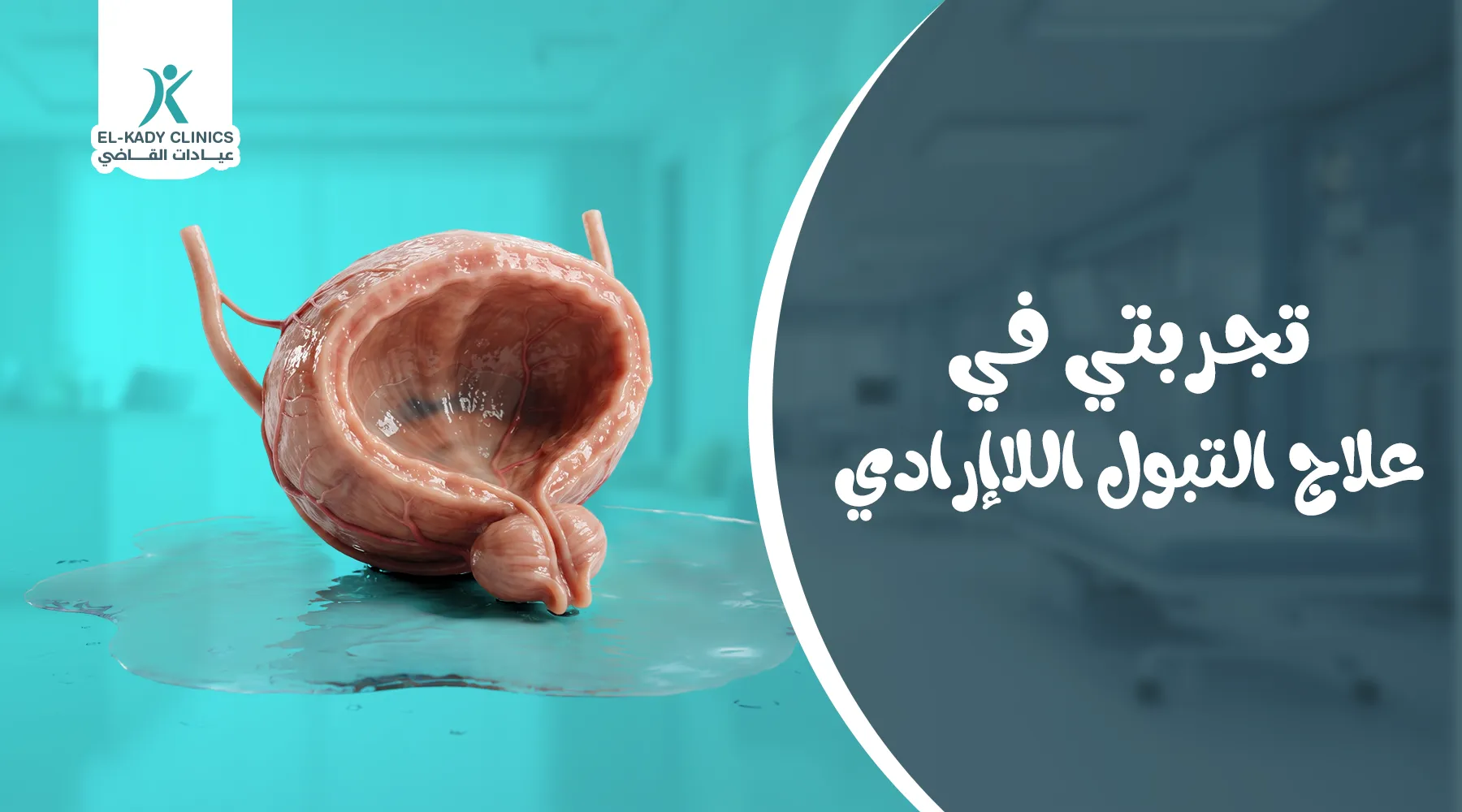 تجربتي في علاج التبول اللاإرادي مع ابني