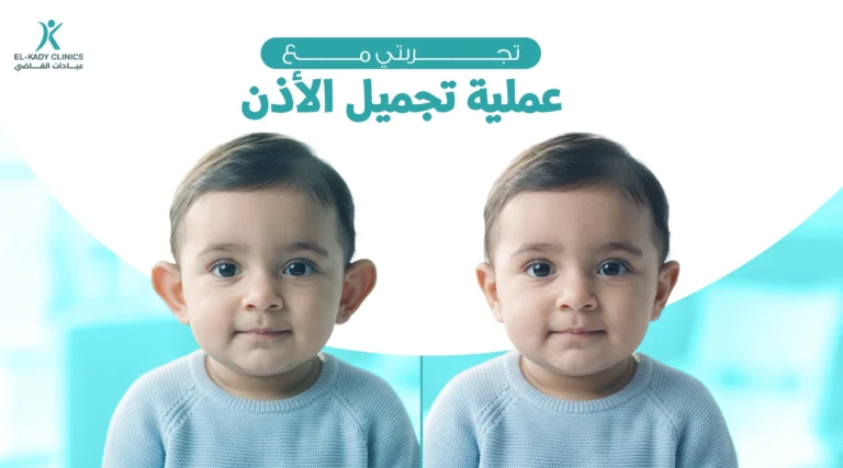 تجربتي مع عملية تجميل الأذن البارزة الخفاشية
