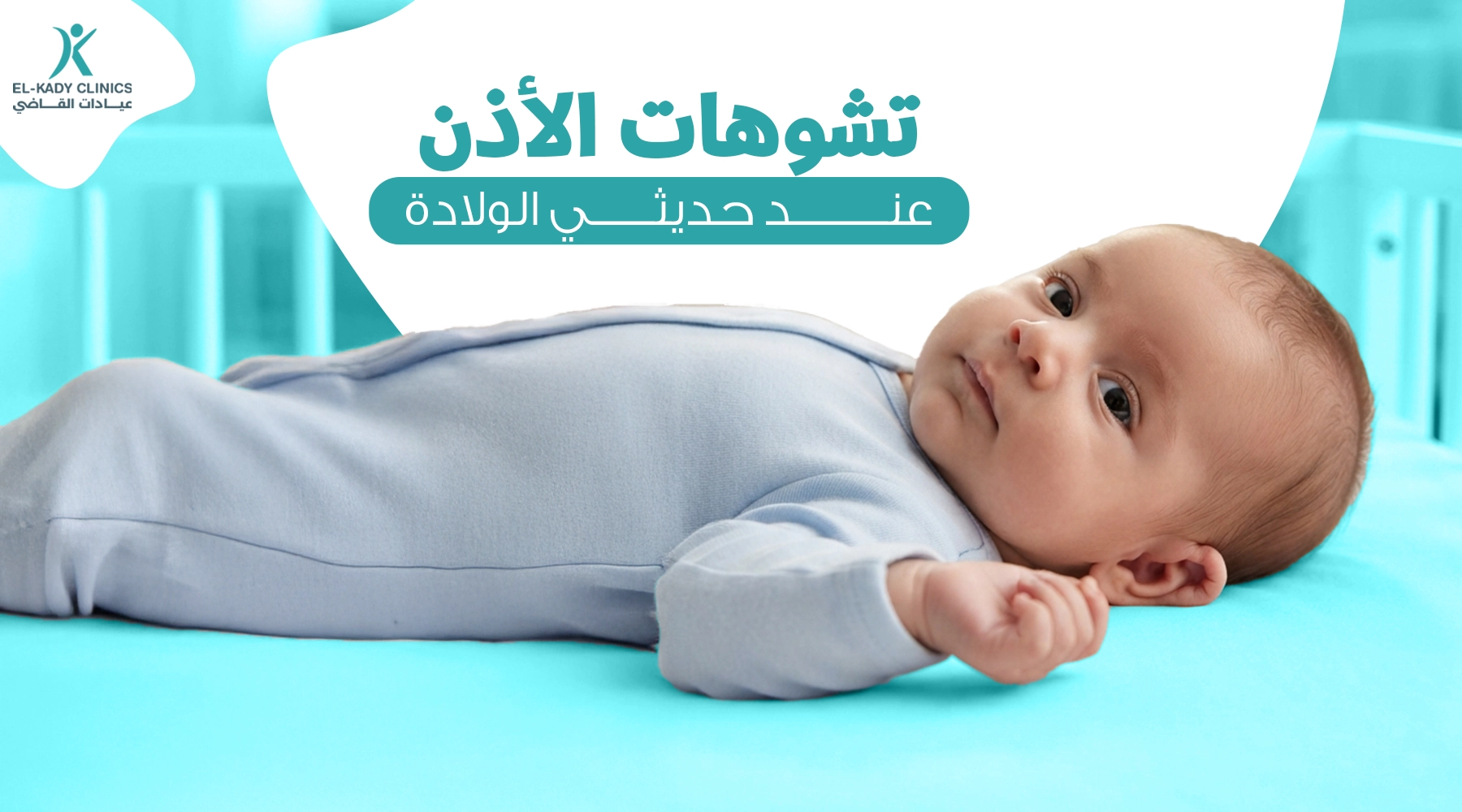 أشكال تشوهات الأذن عند حديثي الولادة