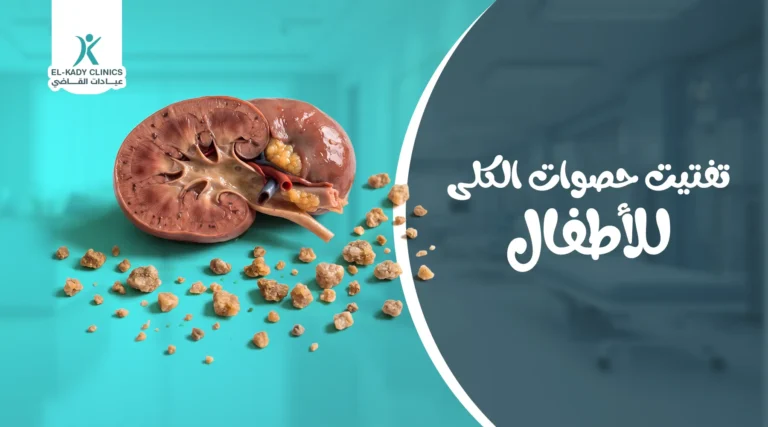 تقنيات تفتيت حصوات الكلى للأطفال
