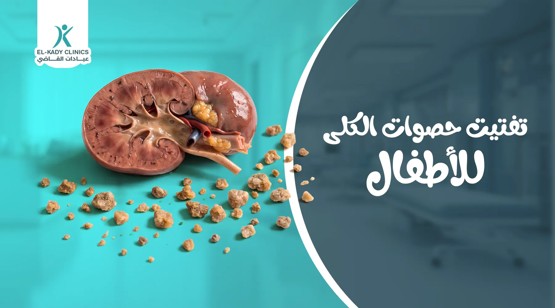 تقنيات تفتيت حصوات الكلى للأطفال
