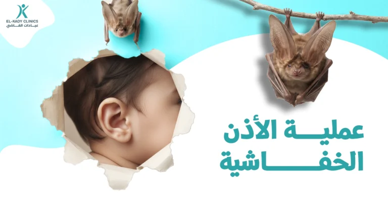 عملية الأذن الخفاشية للأطفال