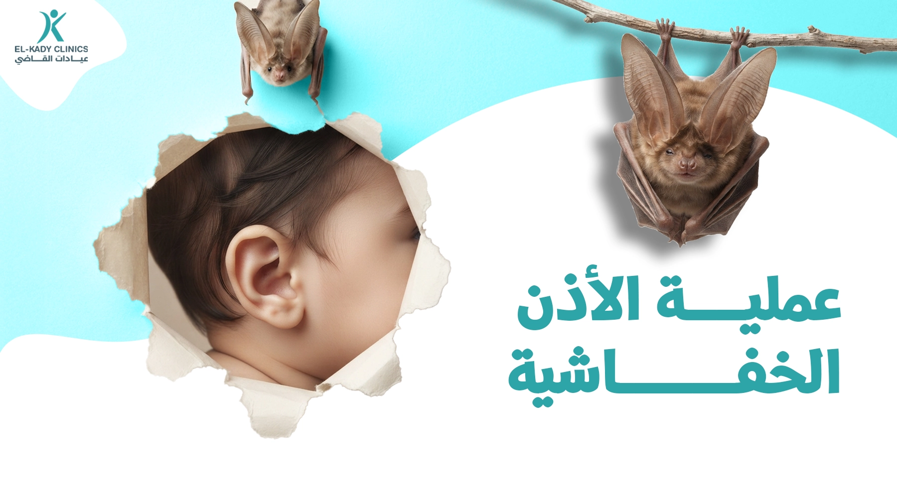 عملية الأذن الخفاشية للأطفال