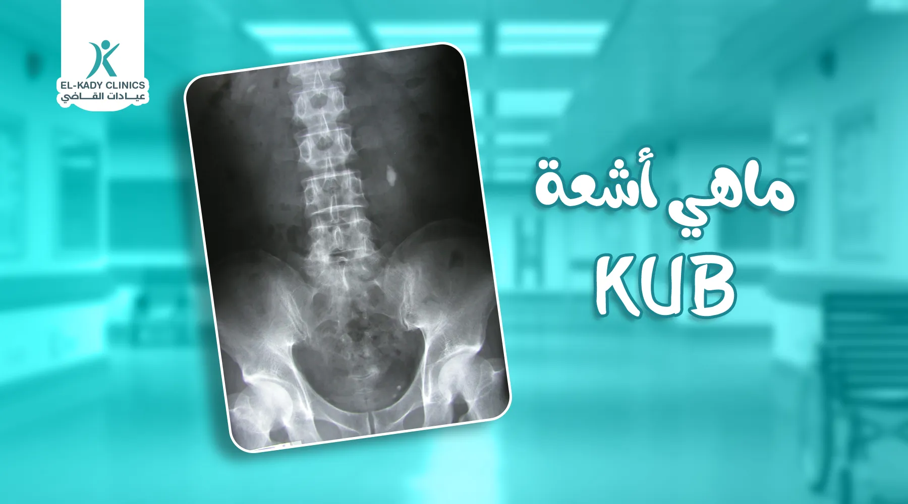 ماهي أشعة KUB للأطفال؟